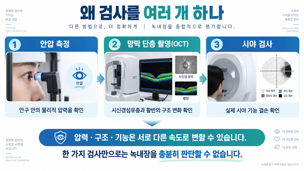 안압 측정·시신경 단층촬영·시야 검사의 역할