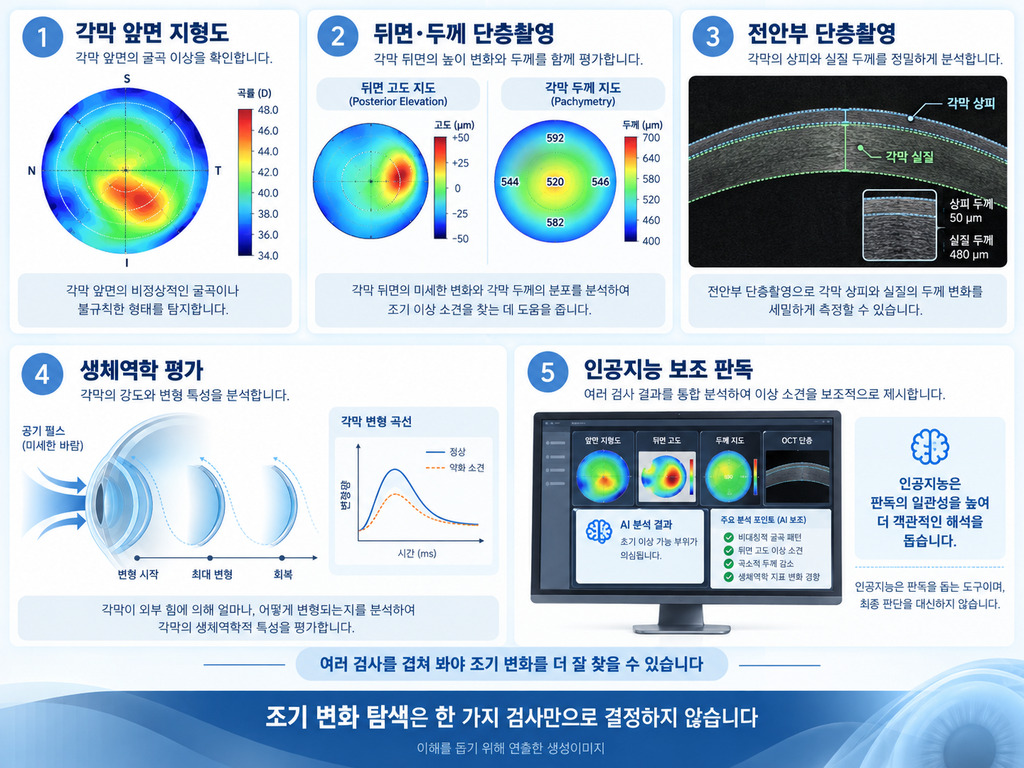 각막지형도·단층촬영·생체역학으로 조기 변화를 찾는 방법