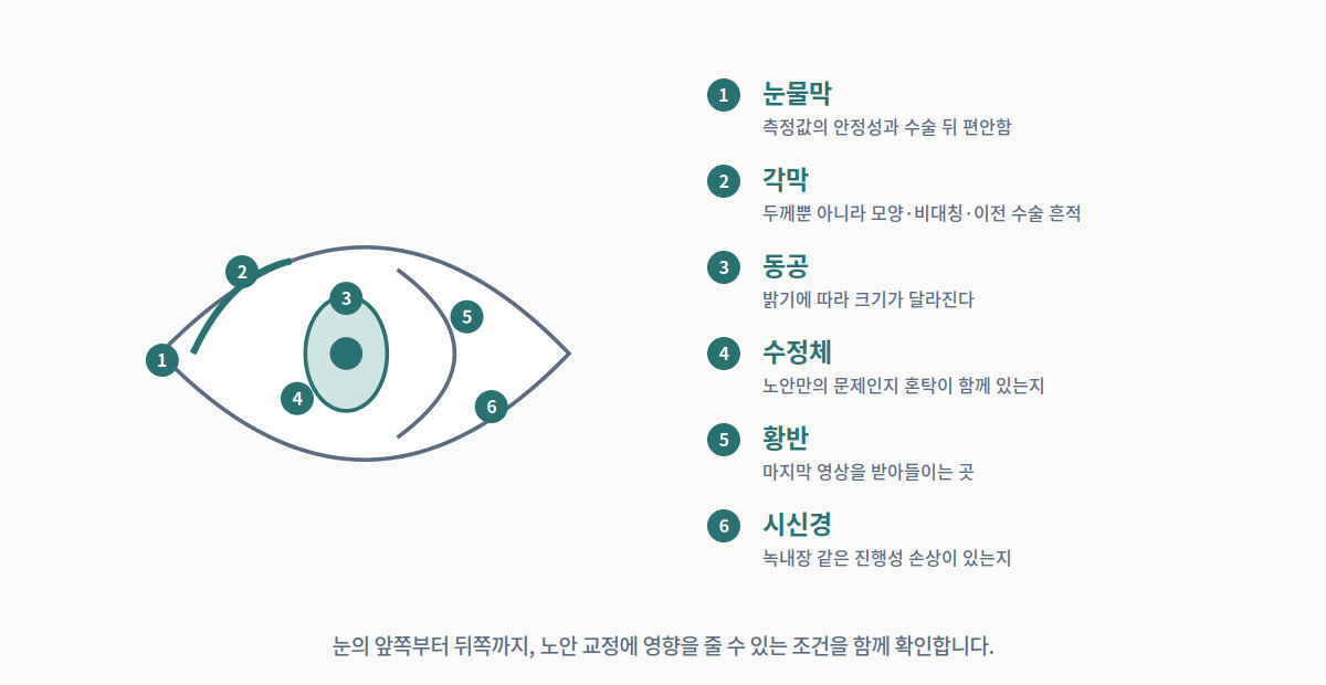 노안 교정 상담에서 확인하는 검사 항목을 눈의 앞쪽부터 뒤쪽까지 위치별로 표시한 그림.