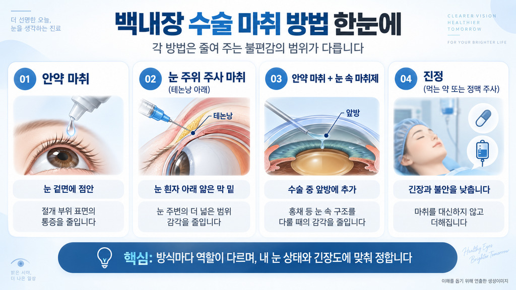 안약 마취·눈 주위 주사·전방 내 마취·진정의 차이를 나눈 그림